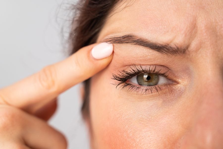 Quando considerar fazer a blefaroplastia?